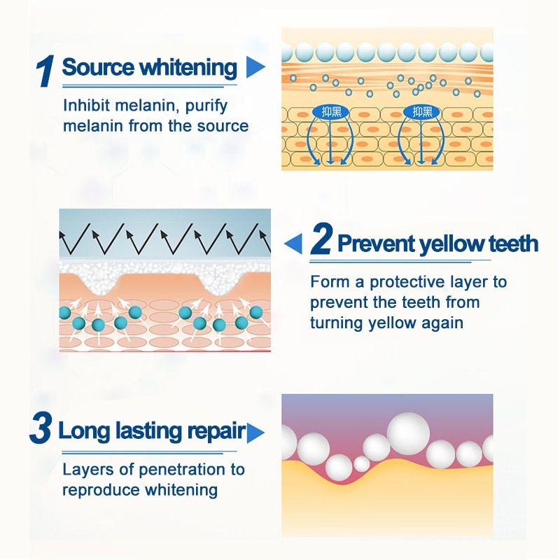 Dazzling White Instant Teeth Whitening Pen - Image 5