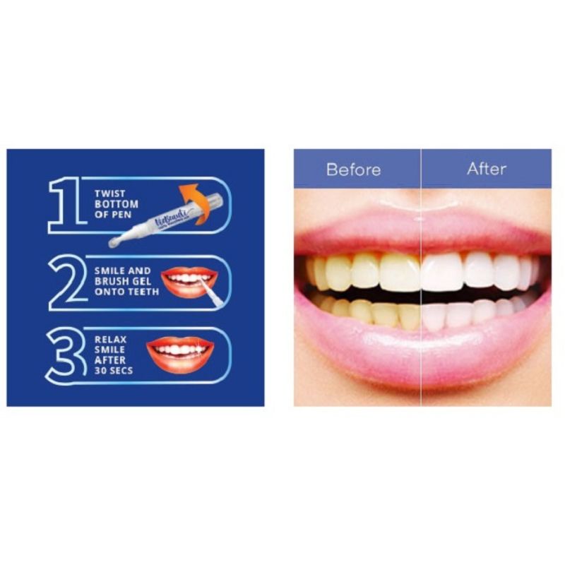 Dazzling White Instant Teeth Whitening Pen - Image 4