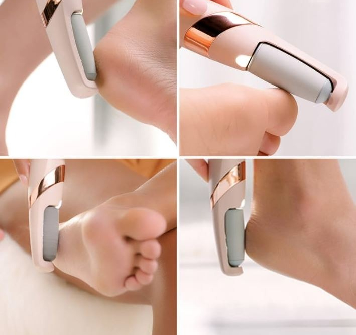 Rechargeable Electric Pedi Foot Filer – Effective Callus Remover for Soft, Smooth Feet - Image 4
