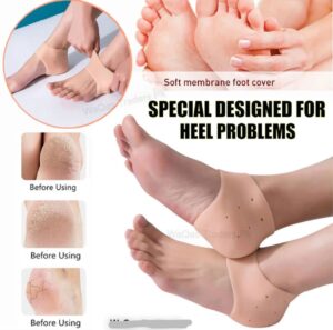Pair of half Heel Pain Anti Crack Silicone Set – Anti Crack  For Pain Relief Unisex With Box