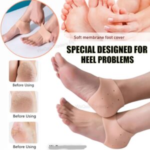 Pair of half Heel Pain Anti Crack Silicone Set - Anti Crack  For Pain Relief Unisex With Box
