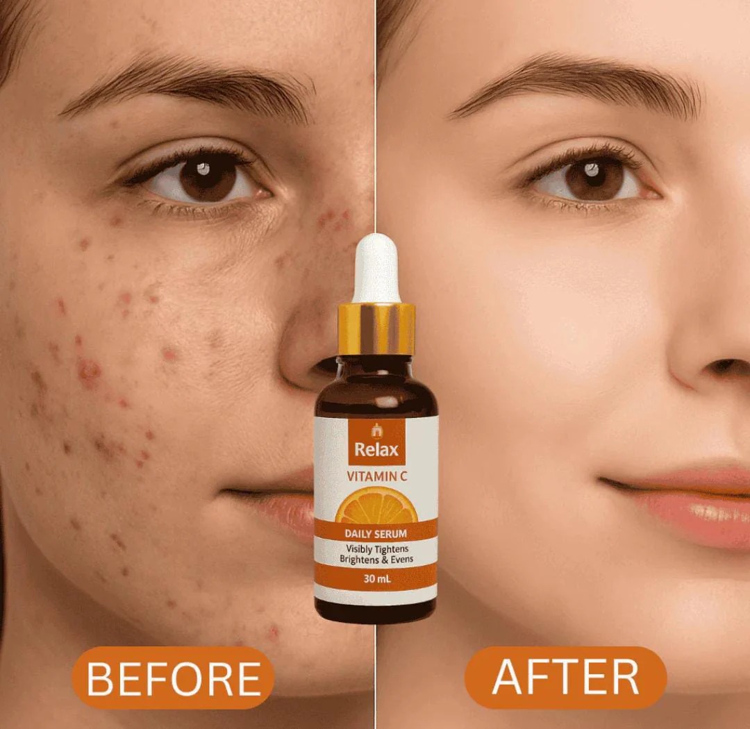 Relax Vitamin C Daily Serum – Glow And Radiance In Every Drop With Brightening Anti Aging Hydration Formula For Healthy Skin – Net Quantity 30ml - Image 2
