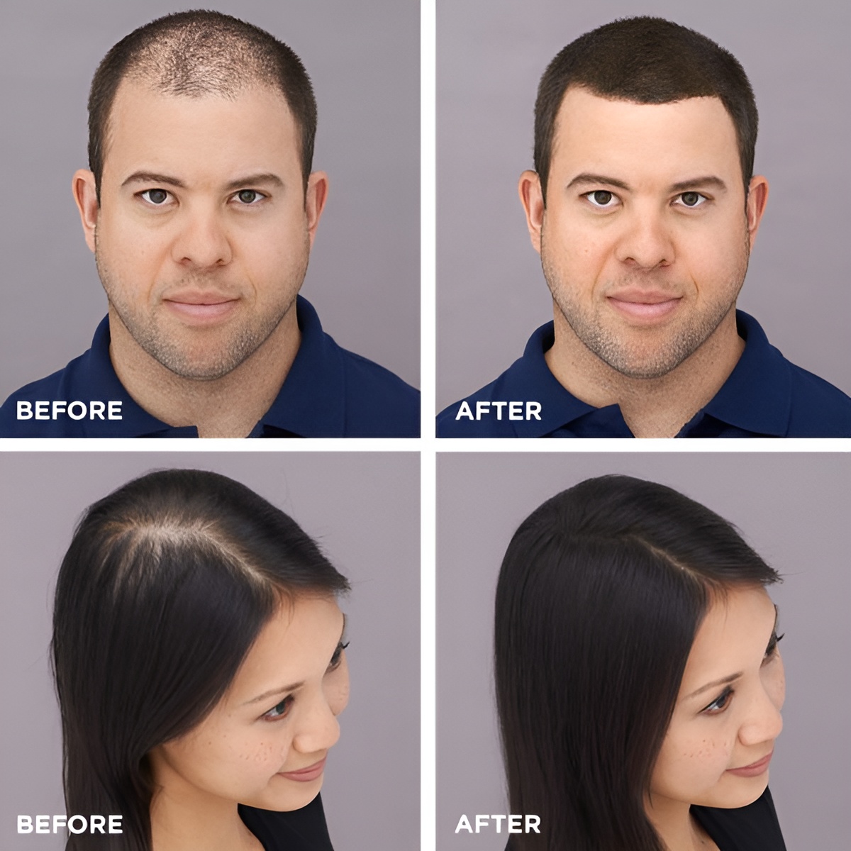 Toppik Hair Building Fiber Fuller Looking Hair for Men & Women (27.5g) - Image 3